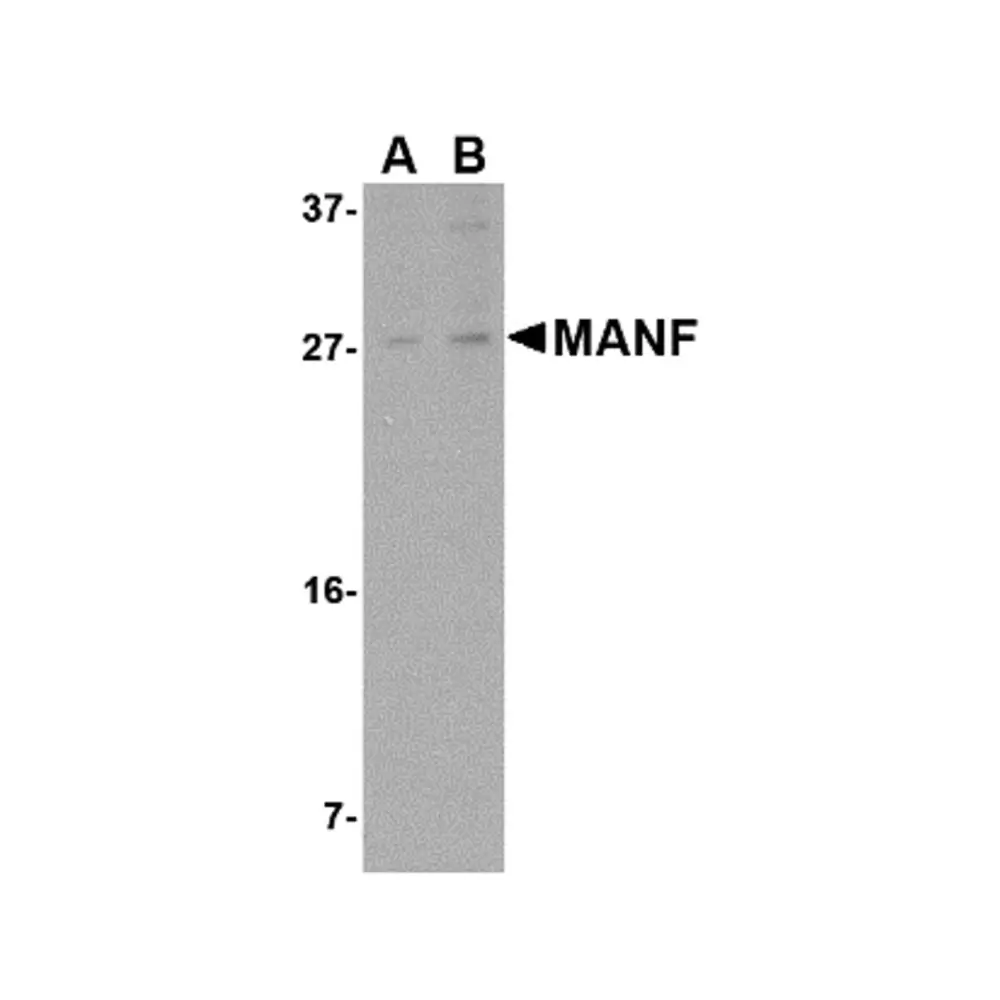ProSci 4349 MANF Antibody, ProSci, 0.1 mg/Unit Tertiary Image