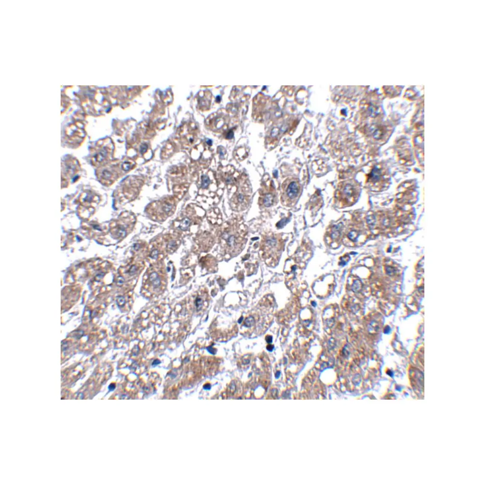ProSci 5125 MATN1 Antibody, ProSci, 0.1 mg/Unit Secondary Image