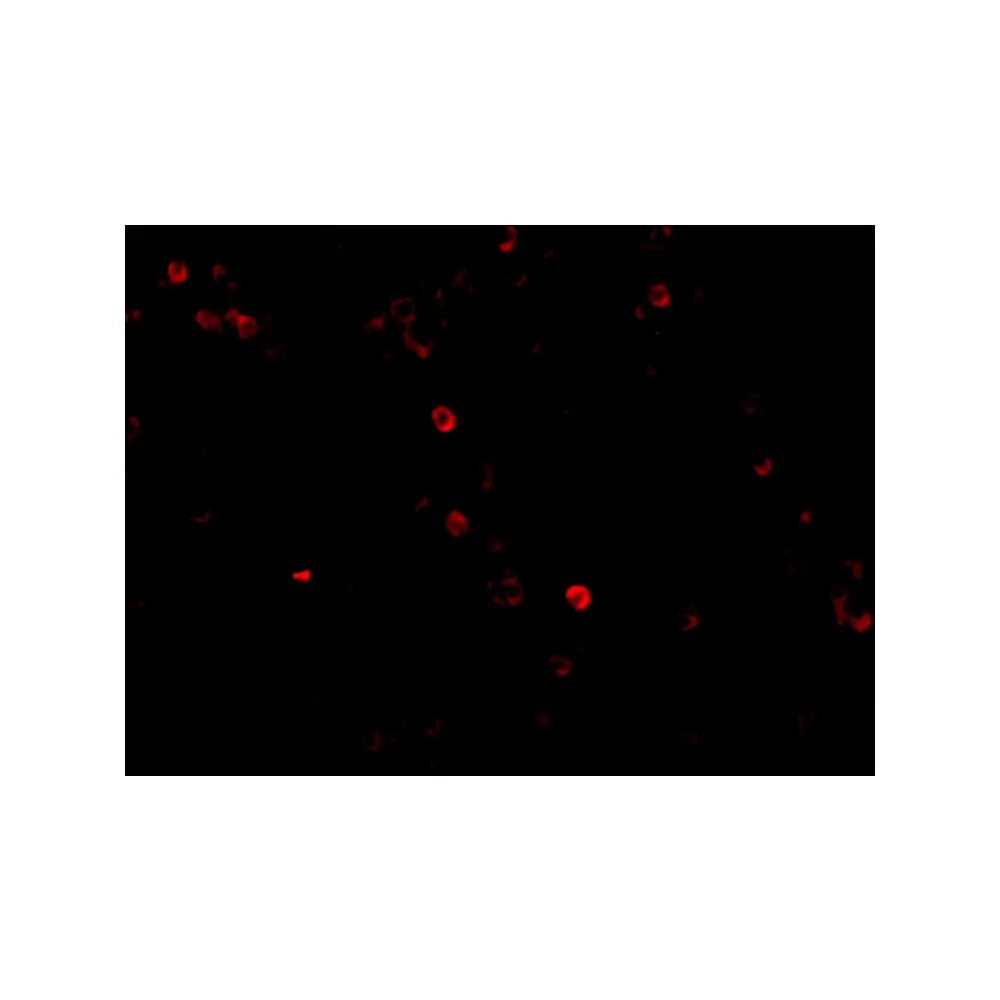 ProSci 4037 MDA5 Antibody, ProSci, 0.1 mg/Unit Tertiary Image