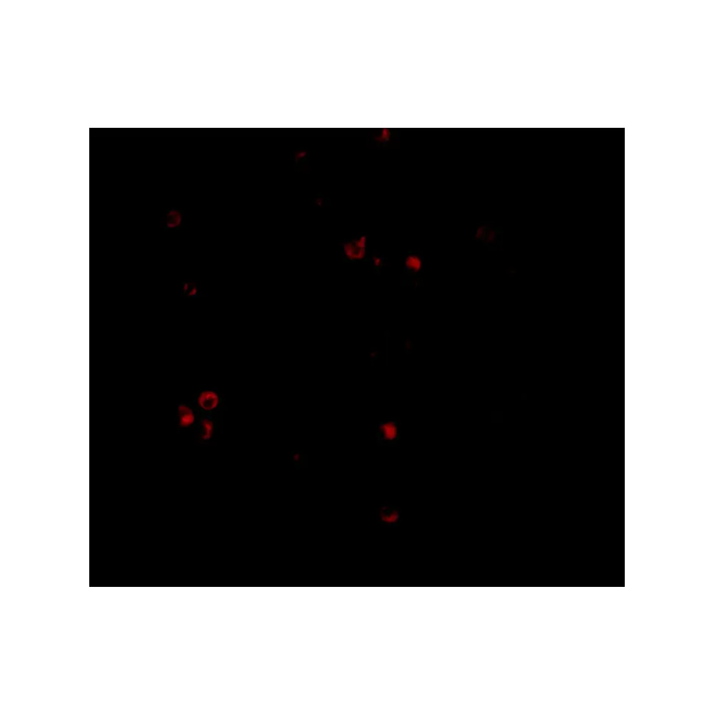 ProSci 4039 MDA5 Antibody, ProSci, 0.1 mg/Unit Tertiary Image