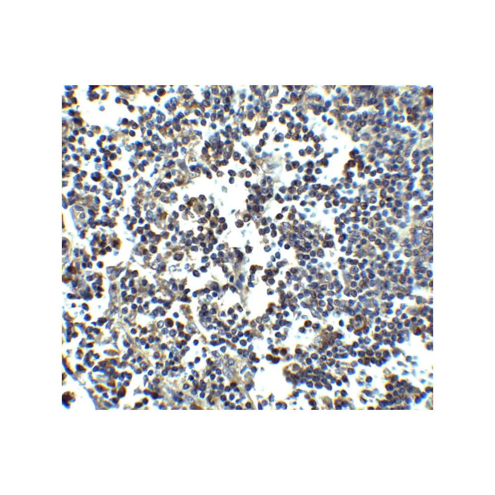 ProSci 4037 MDA5 Antibody, ProSci, 0.1 mg/Unit Secondary Image