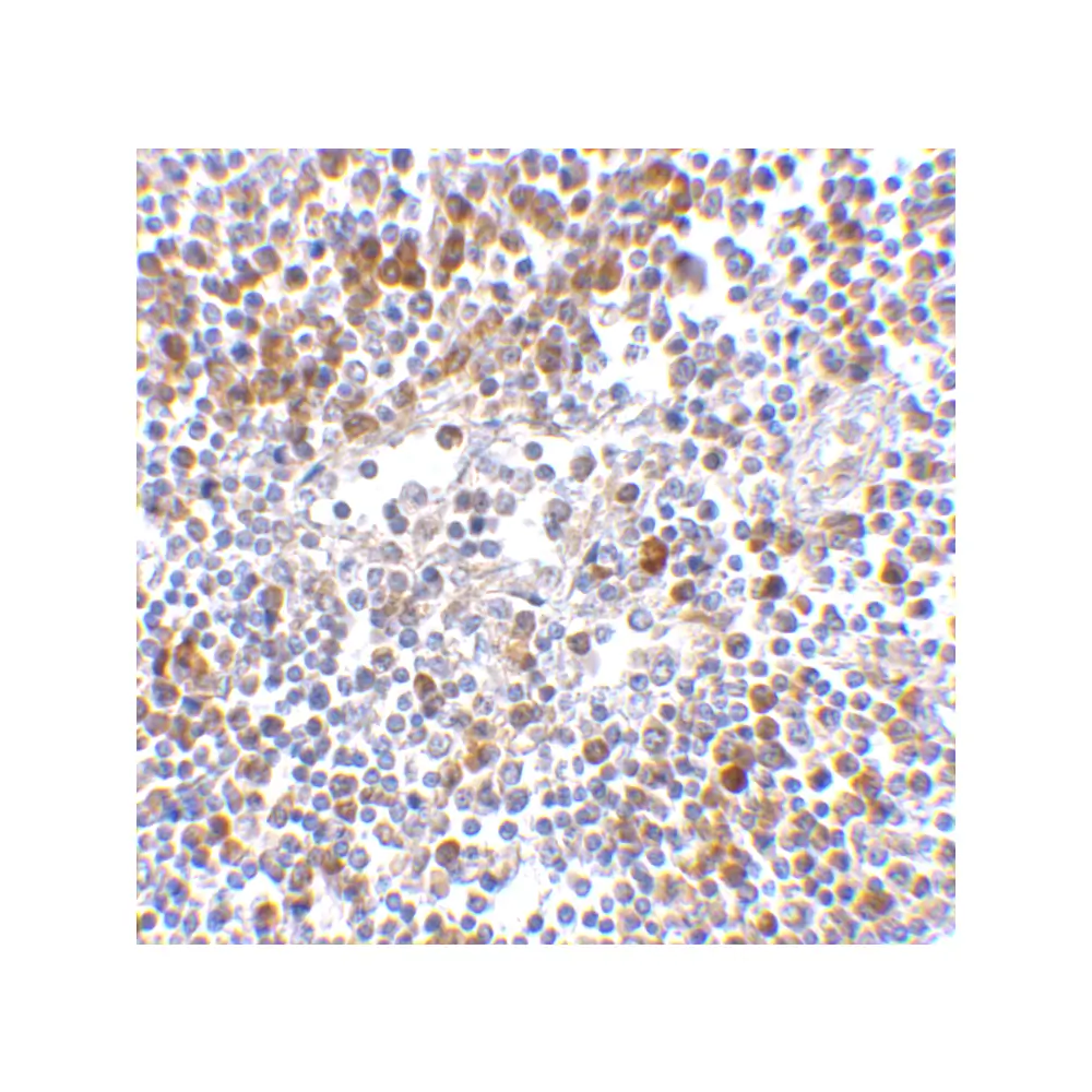 ProSci 4037 MDA5 Antibody, ProSci, 0.1 mg/Unit Quaternary Image