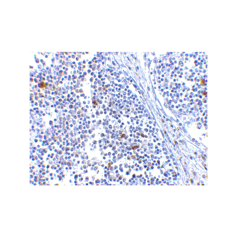 ProSci 4039 MDA5 Antibody, ProSci, 0.1 mg/Unit Secondary Image