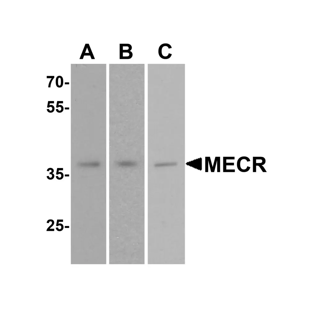 ProSci 7151_S MECR Antibody, ProSci, 0.02 mg/Unit Secondary Image