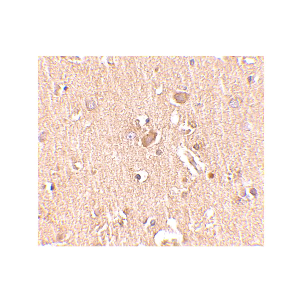 ProSci 4731 MED28 Antibody, ProSci, 0.1 mg/Unit Secondary Image