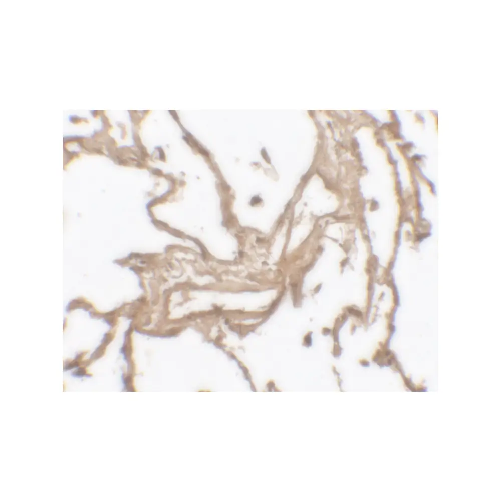ProSci 7471 MMP9 Antibody , ProSci, 0.1 mg/Unit Secondary Image