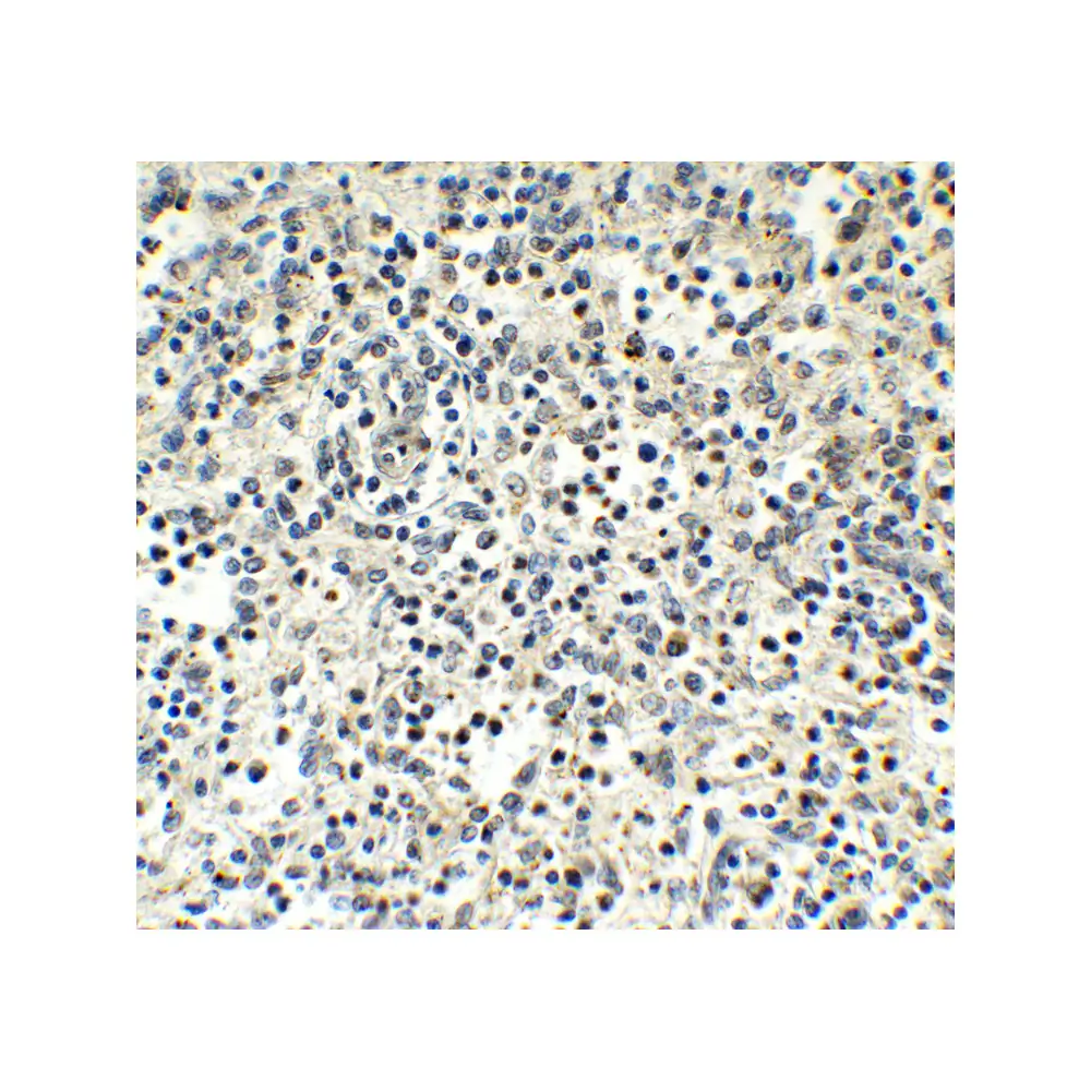 ProSci 9645_S MNDA (CT) Antibody, ProSci, 0.02 mg/Unit Secondary Image