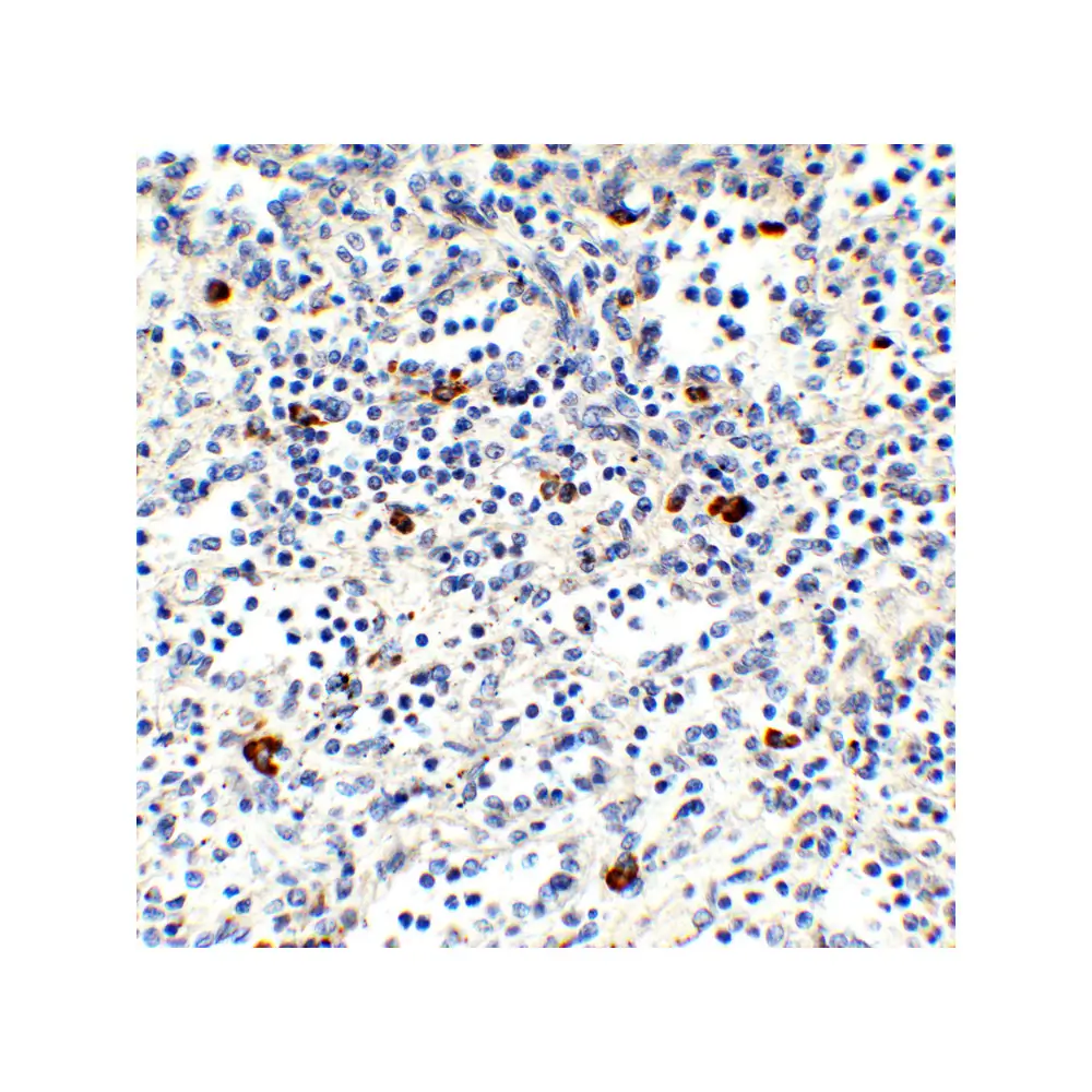 ProSci 9647_S MNDA (IN) Antibody, ProSci, 0.02 mg/Unit Secondary Image