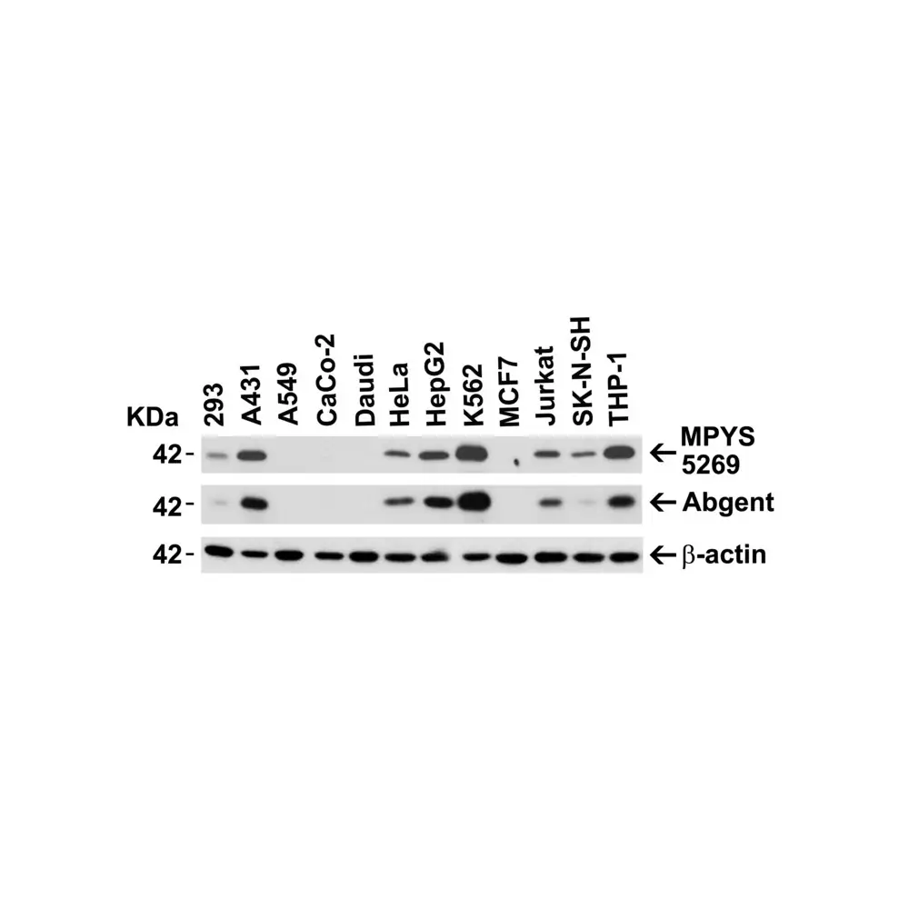 ProSci 5269_S MPYS Antibody, ProSci, 0.02 mg/Unit Primary Image