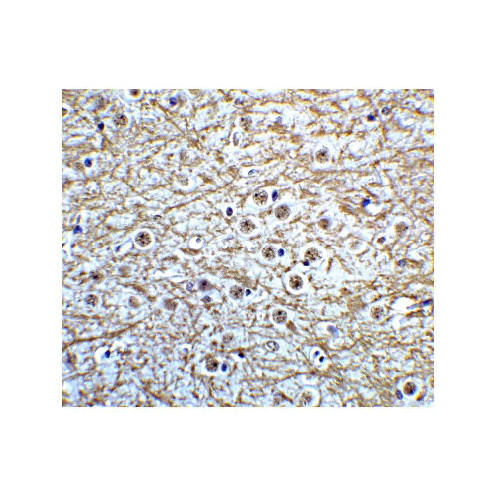 ProSci 6309_S MSI2 Antibody, ProSci, 0.02 mg/Unit Quaternary Image