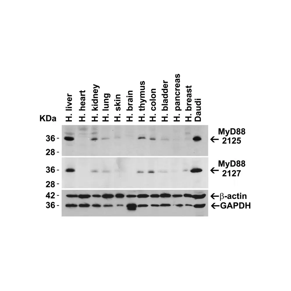 ProSci 2127_S MYD88 Antibody, ProSci, 0.02 mg/Unit Quaternary Image