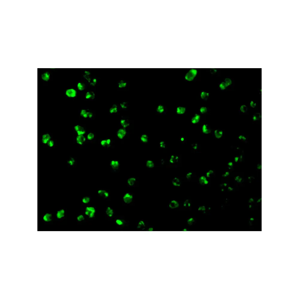 ProSci 3477 Mcl-1 Antibody, ProSci, 0.1 mg/Unit Tertiary Image