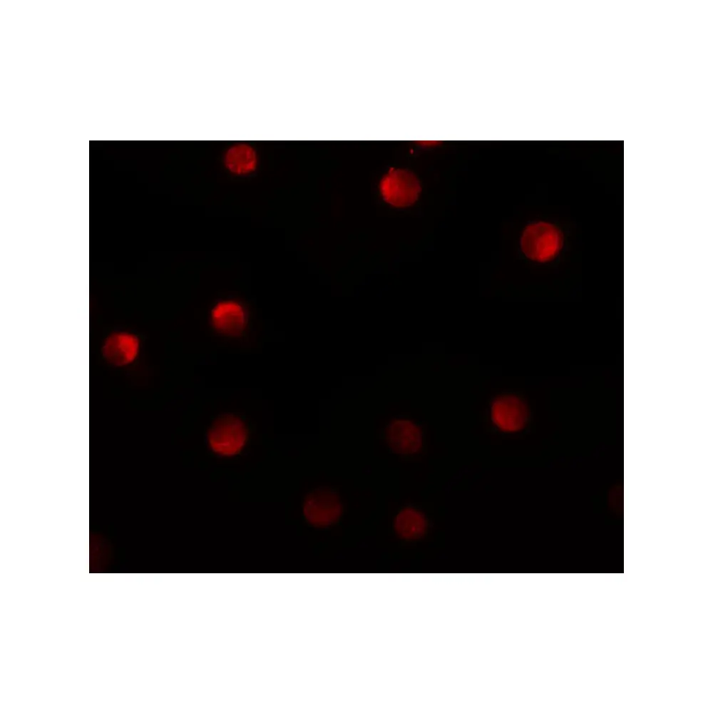 ProSci 6175_S N4BP1 Antibody, ProSci, 0.02 mg/Unit Tertiary Image