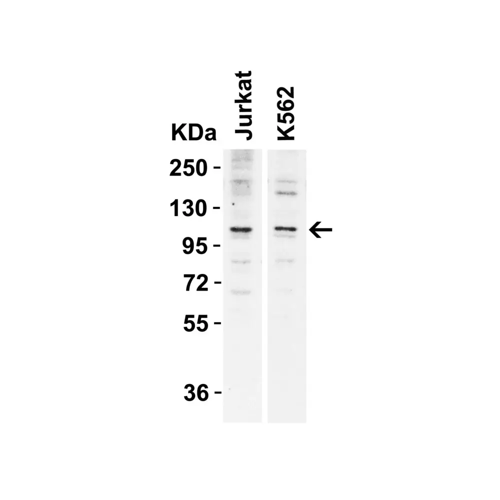 ProSci 6175 N4BP1 Antibody, ProSci, 0.1 mg/Unit Primary Image