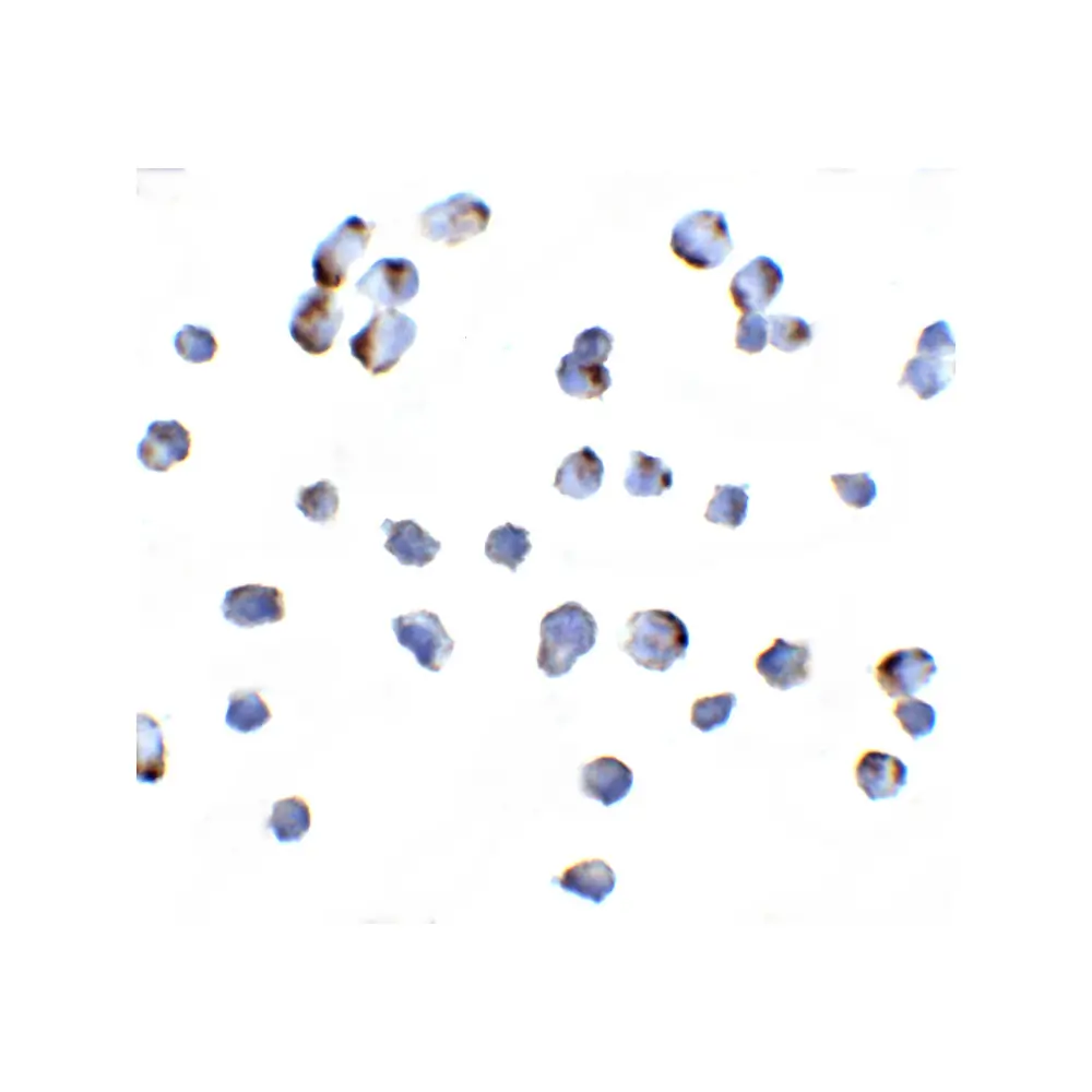 ProSci 1129 NIK Antibody, ProSci, 0.1 mg/Unit Primary Image