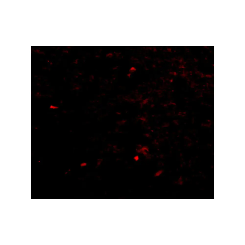 ProSci 4535 NIPSNAP Antibody, ProSci, 0.1 mg/Unit Tertiary Image