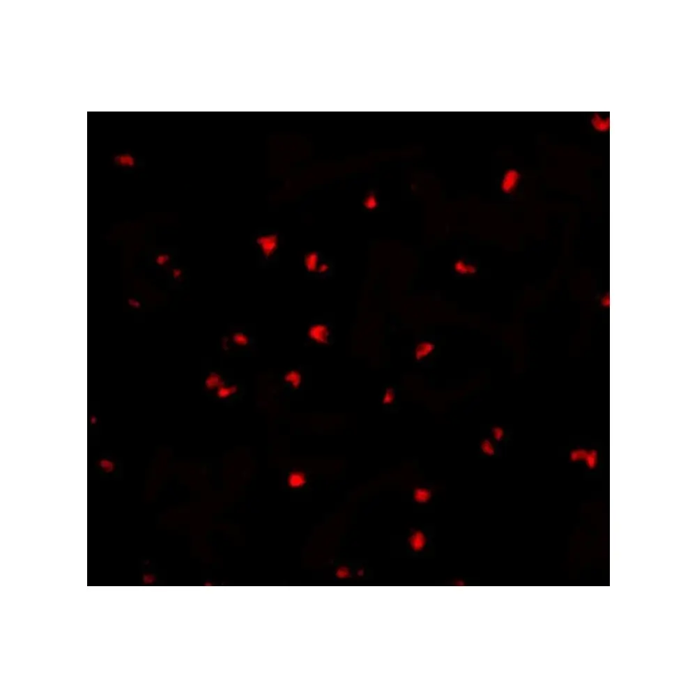 ProSci 2511_S NOD2 Antibody, ProSci, 0.02 mg/Unit Tertiary Image