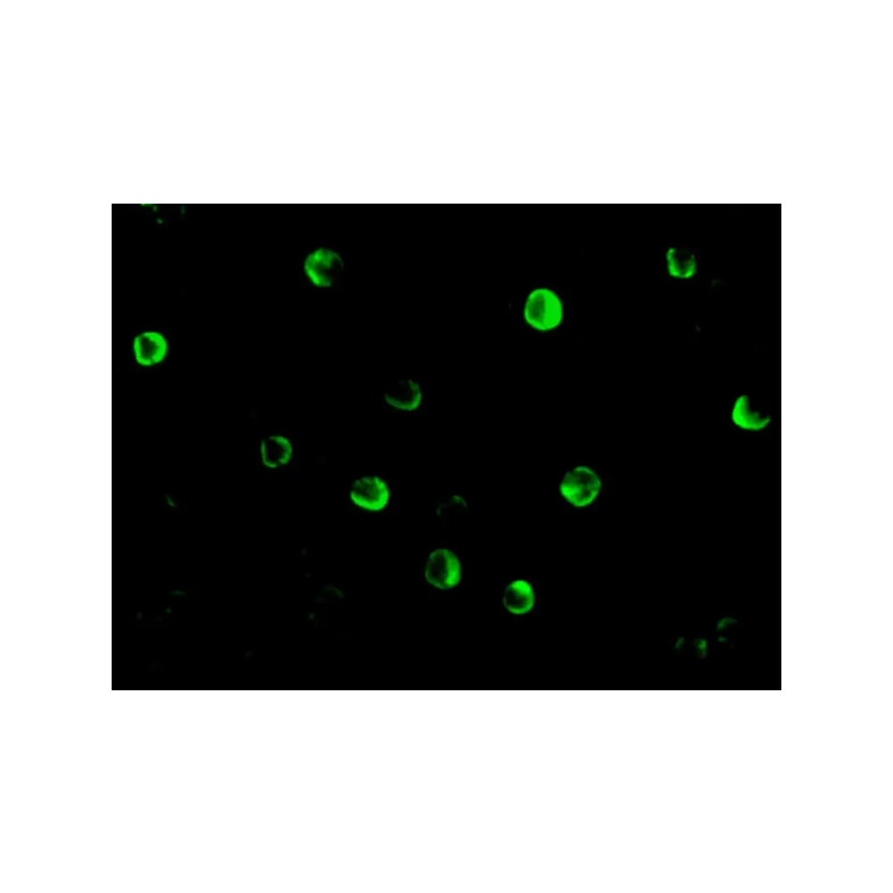 ProSci 2513_S NOD2 Antibody, ProSci, 0.02 mg/Unit Tertiary Image