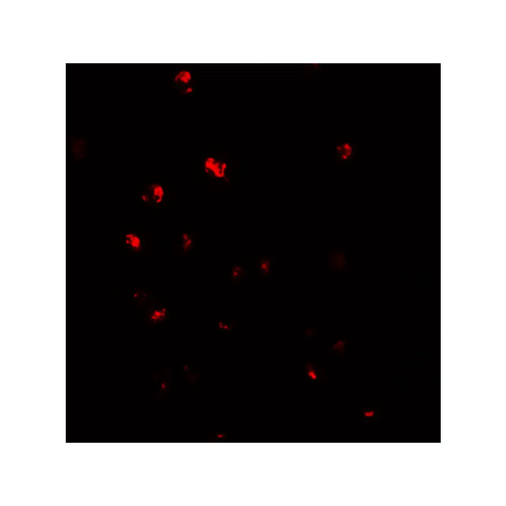 ProSci 5951_S NOD4 Antibody, ProSci, 0.02 mg/Unit Tertiary Image