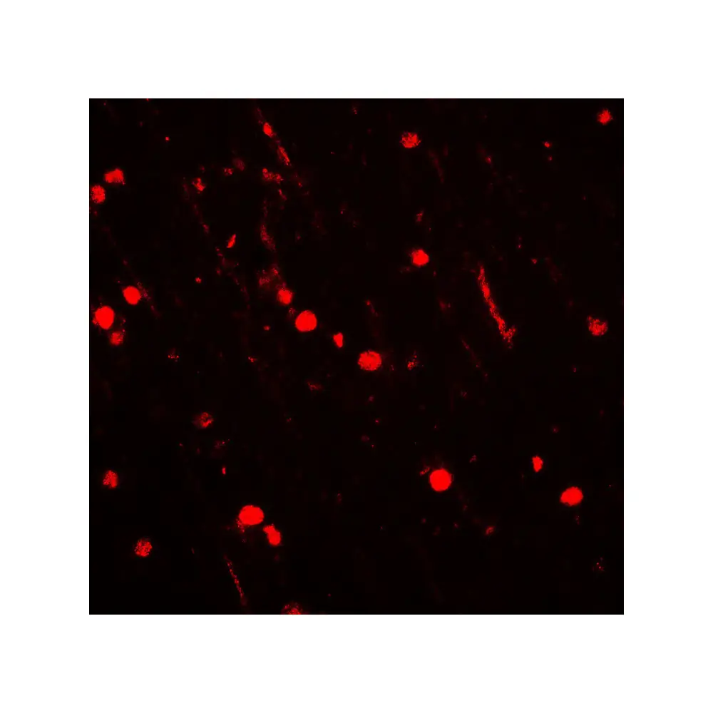 ProSci 7923 NOX2 Antibody, ProSci, 0.1 mg/Unit Tertiary Image