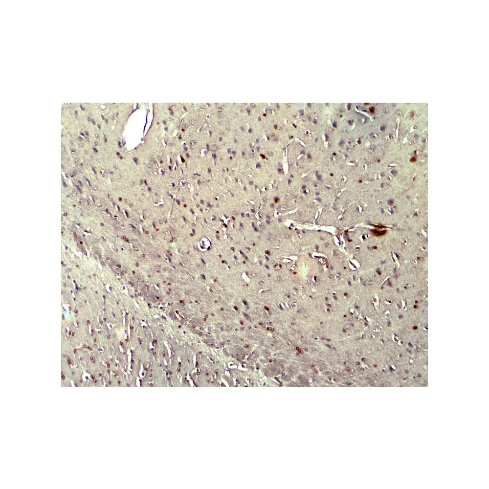 ProSci 7923 NOX2 Antibody, ProSci, 0.1 mg/Unit Secondary Image