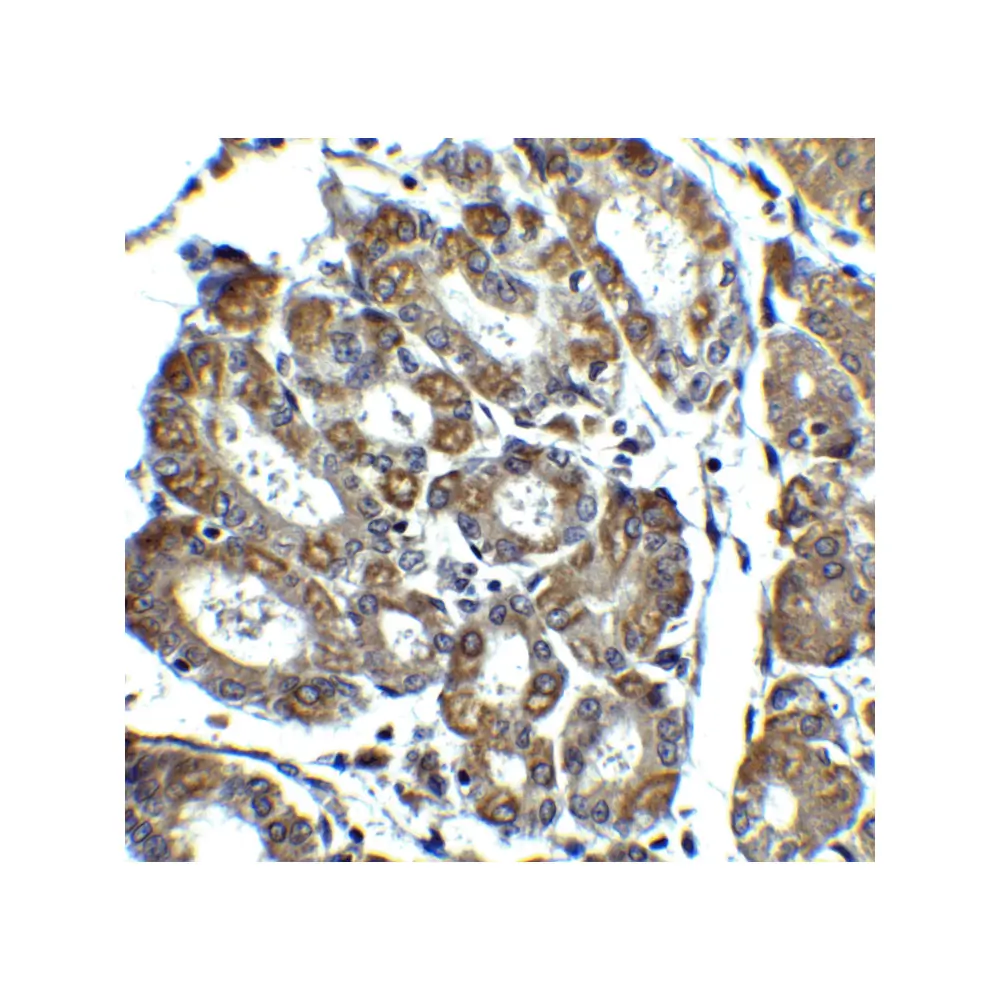 ProSci 2437_S Noxa Antibody, ProSci, 0.02 mg/Unit Secondary Image