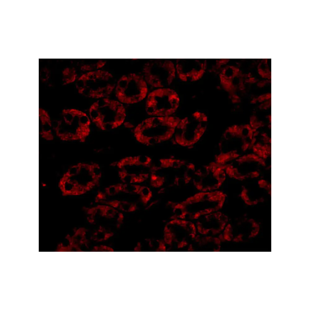 ProSci 5185_S NPC1 Antibody, ProSci, 0.02 mg/Unit Tertiary Image