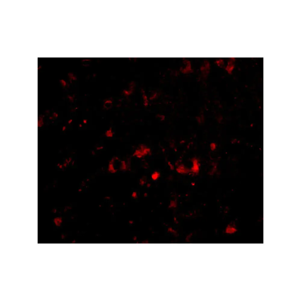 ProSci 4573_S NPTX2 Antibody, ProSci, 0.02 mg/Unit Quaternary Image