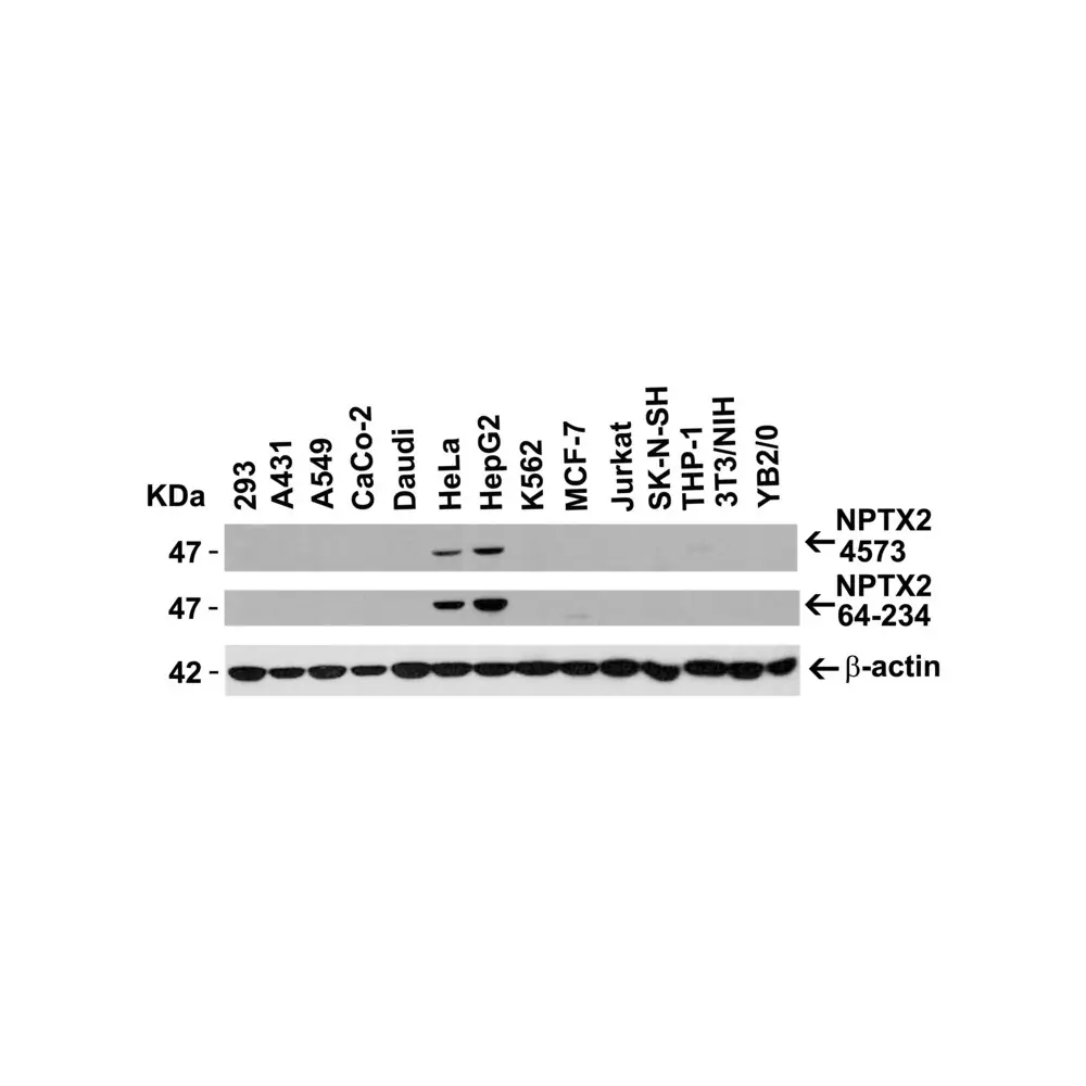ProSci 4573 NPTX2 Antibody, ProSci, 0.1 mg/Unit Secondary Image