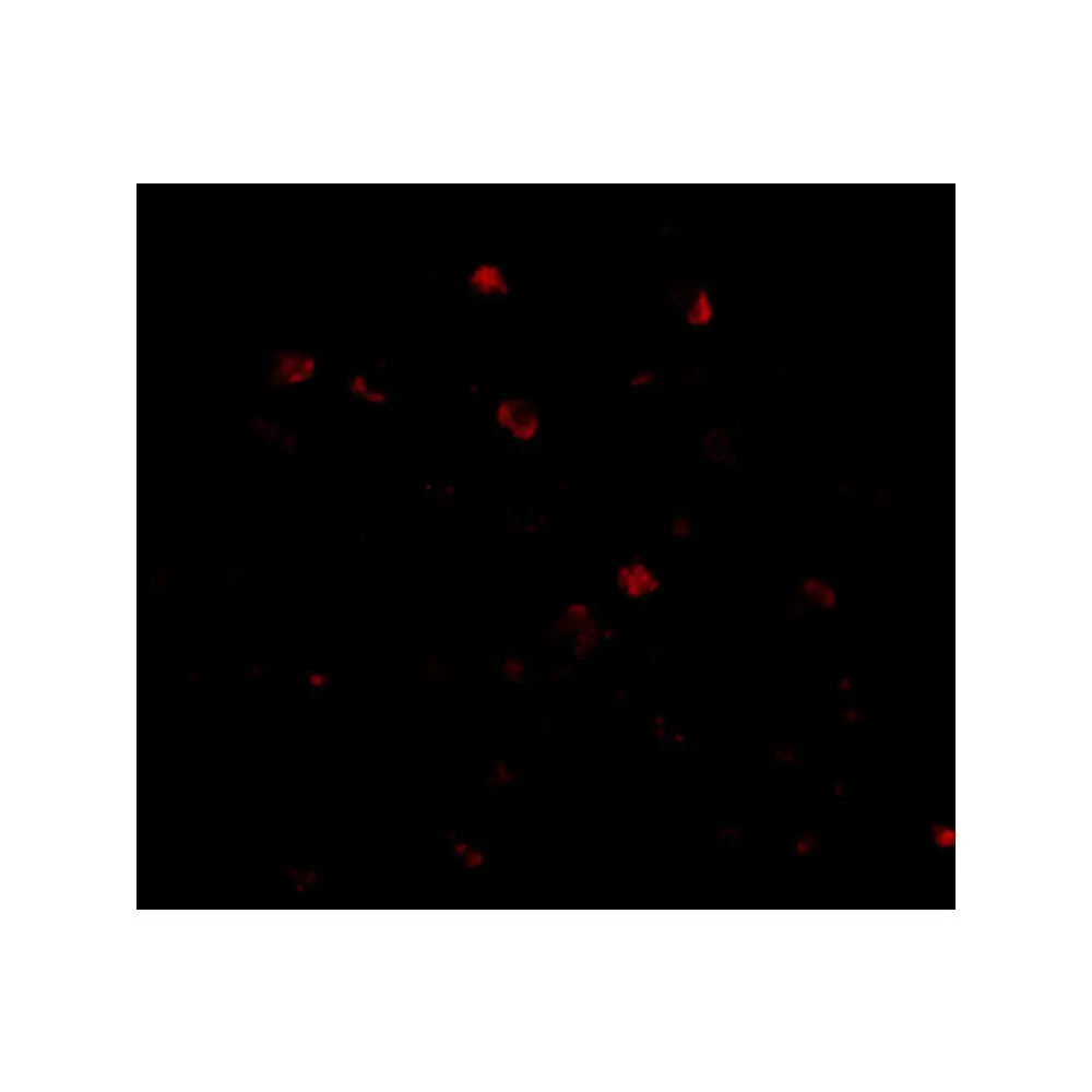 ProSci 4707_S NUP160 Antibody, ProSci, 0.02 mg/Unit Tertiary Image