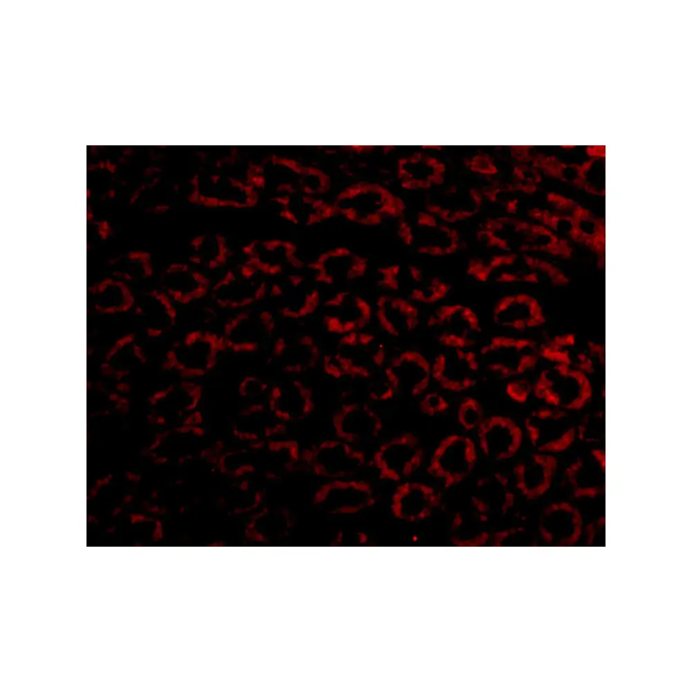 ProSci 2265 Nephrin Antibody, ProSci, 0.1 mg/Unit Quaternary Image