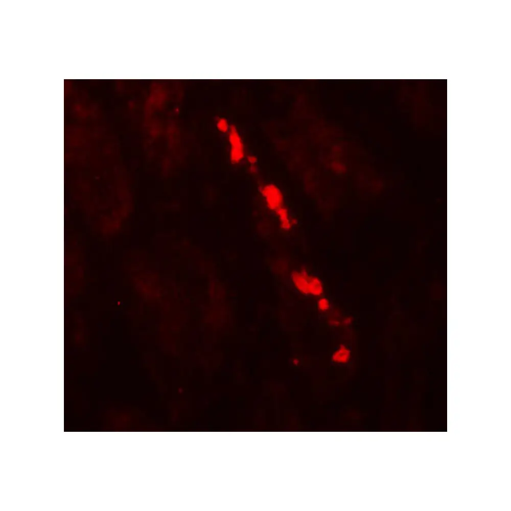ProSci 7979 Nephrin Antibody, ProSci, 0.1 mg/Unit Quaternary Image