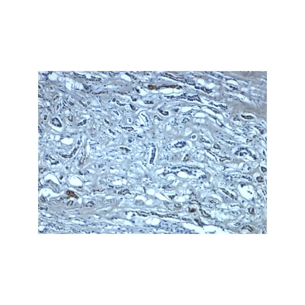 ProSci 7979 Nephrin Antibody, ProSci, 0.1 mg/Unit Tertiary Image