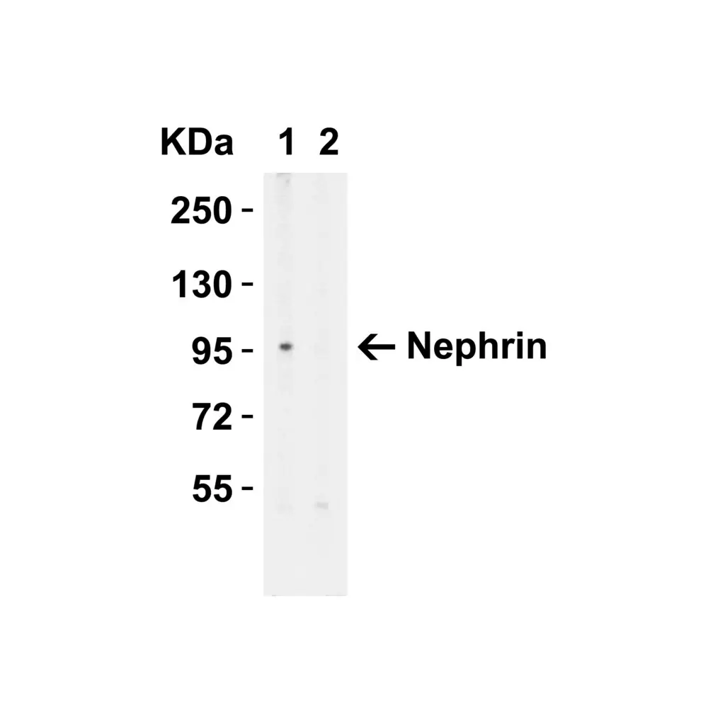ProSci 7979 Nephrin Antibody, ProSci, 0.1 mg/Unit Primary Image
