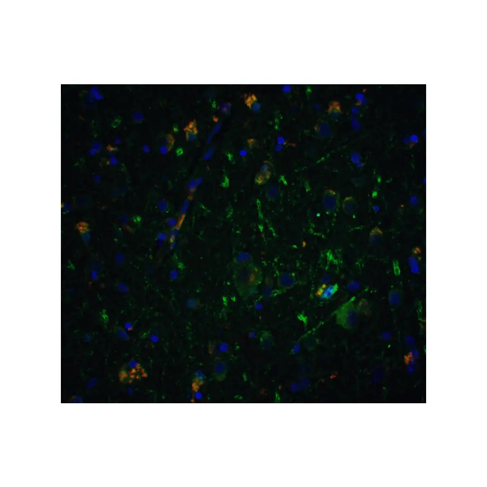 ProSci 1121 Neurturin Antibody, ProSci, 0.1 mg/Unit Tertiary Image