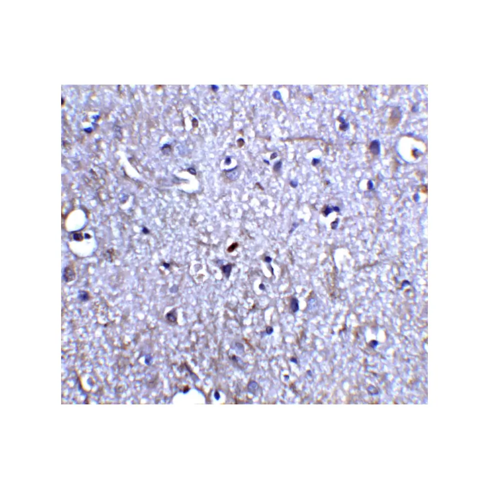 ProSci 1121 Neurturin Antibody, ProSci, 0.1 mg/Unit Quaternary Image