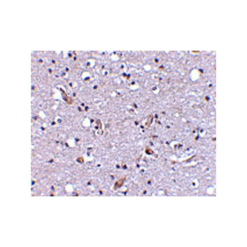 ProSci 4377_S Nhe-1 Antibody, ProSci, 0.02 mg/Unit Secondary Image