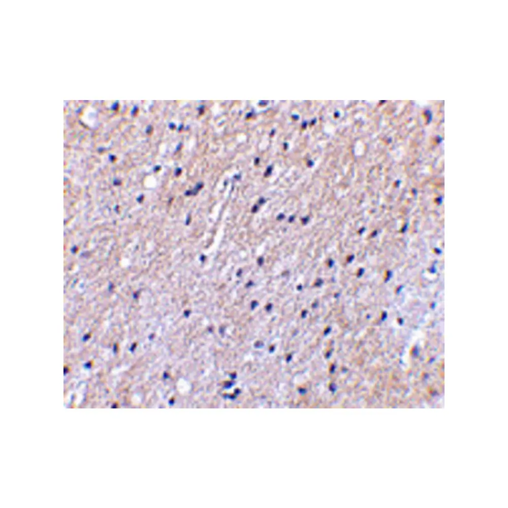 ProSci 4379_S Nhe-1 Antibody, ProSci, 0.02 mg/Unit Secondary Image