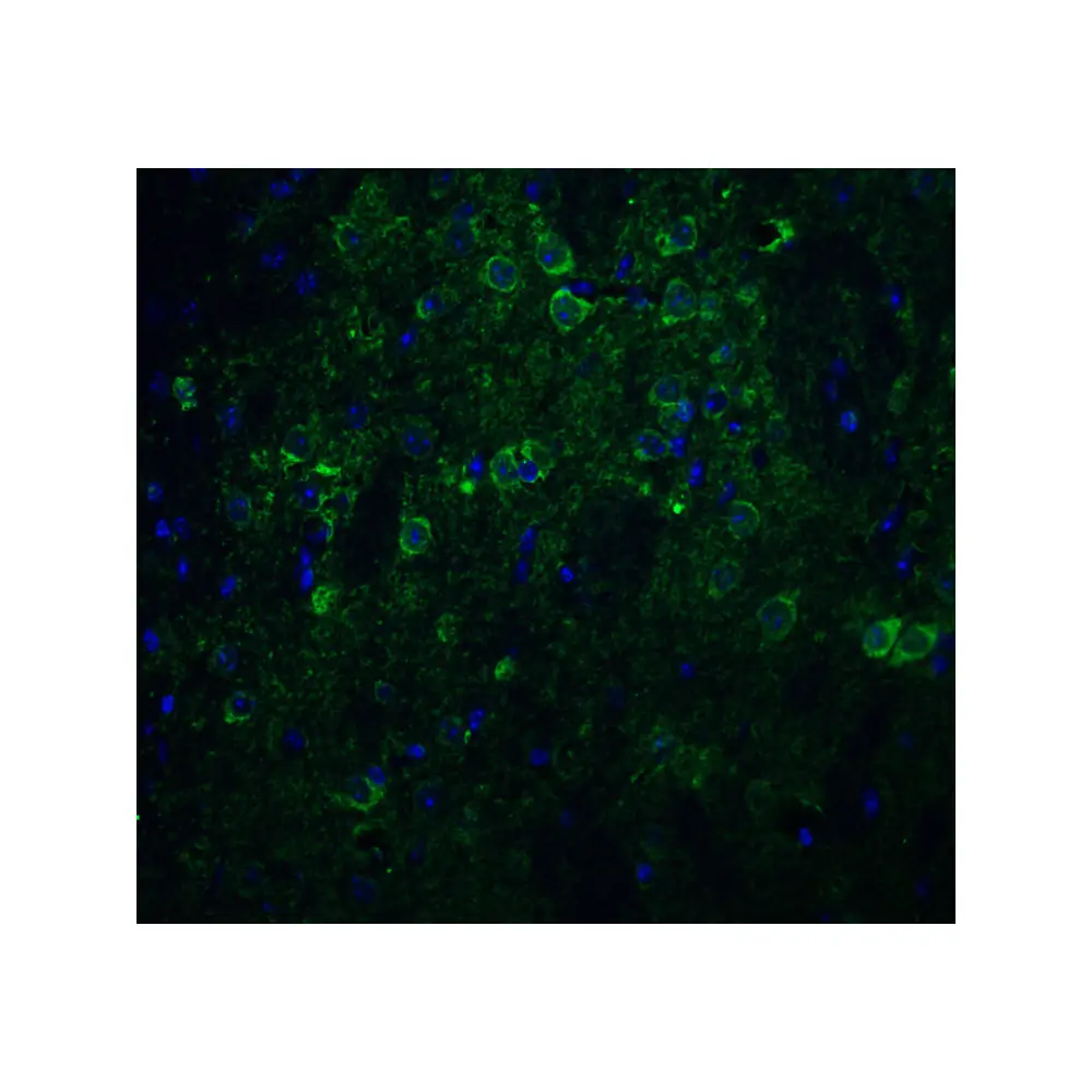 ProSci 3985 Nicastrin Antibody, ProSci, 0.1 mg/Unit Quaternary Image