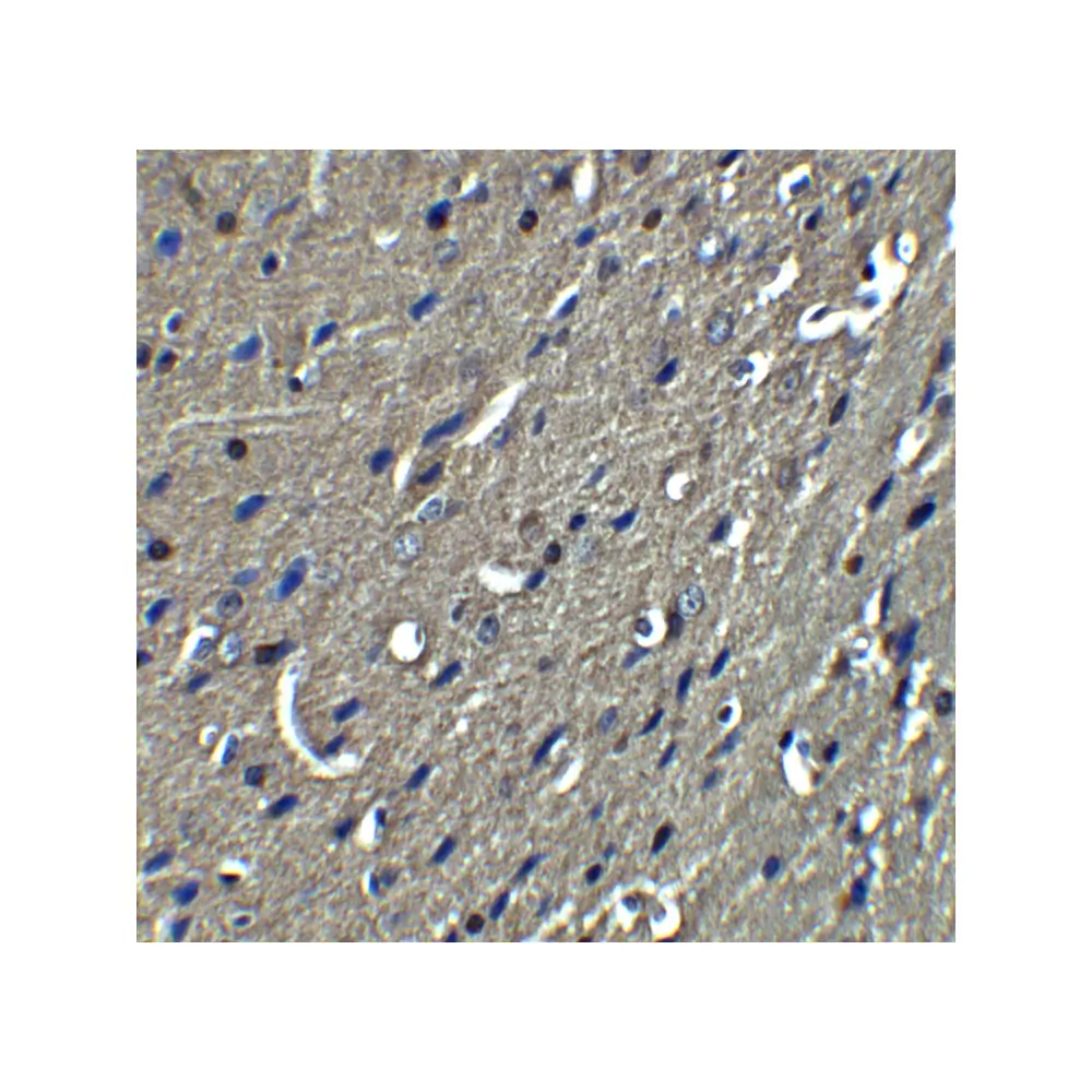 ProSci 4089 NogoA Antibody, ProSci, 0.1 mg/Unit Quaternary Image