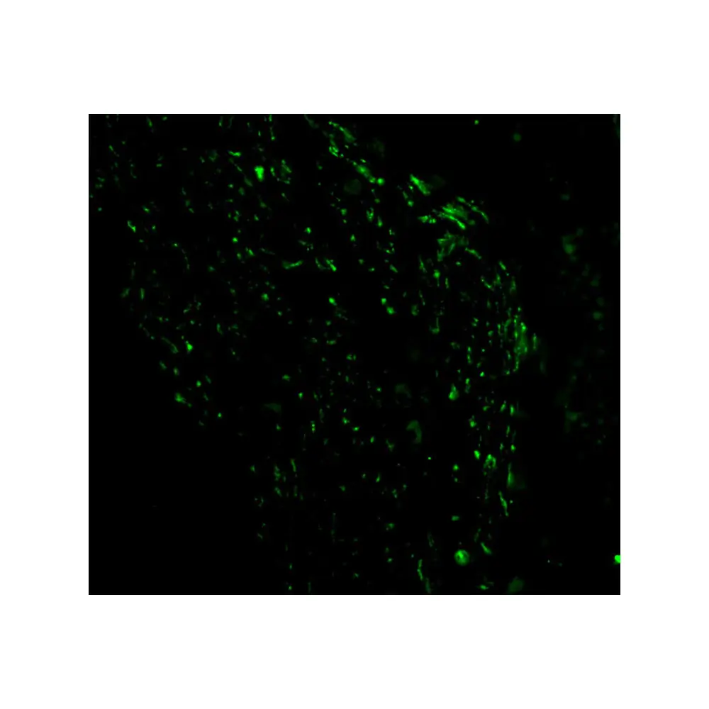 ProSci 2437 Noxa Antibody, ProSci, 0.1 mg/Unit Tertiary Image