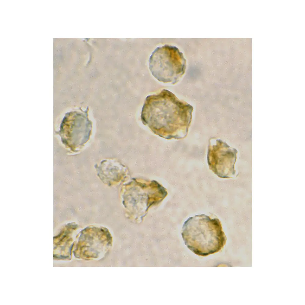 ProSci 3009_S Nudel Antibody, ProSci, 0.02 mg/Unit Secondary Image
