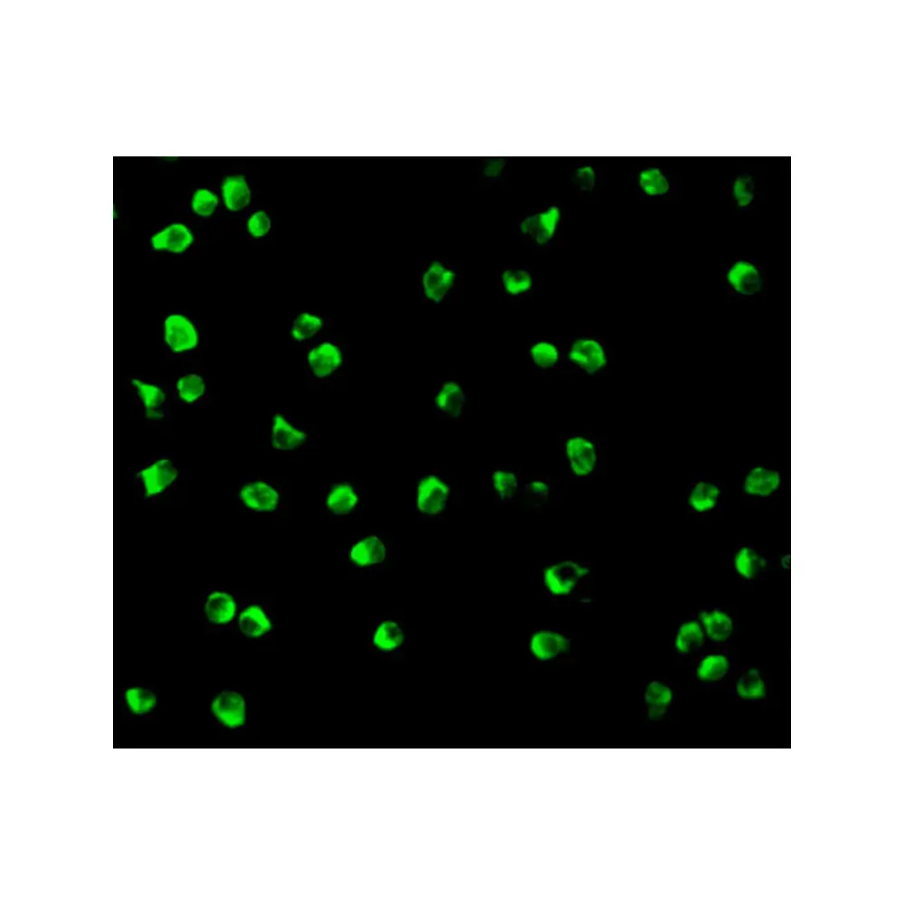 ProSci 3009_S Nudel Antibody, ProSci, 0.02 mg/Unit Tertiary Image