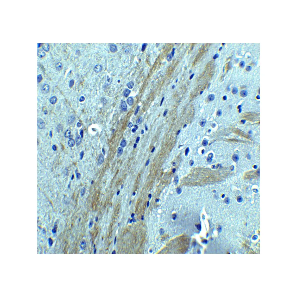 ProSci 5191_S OCLN Antibody, ProSci, 0.02 mg/Unit Senary Image