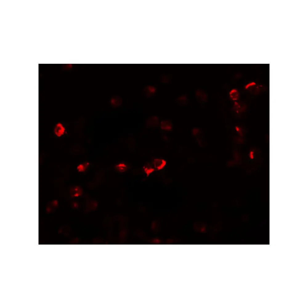 ProSci 6177_S OGFOD1 Antibody, ProSci, 0.02 mg/Unit Secondary Image