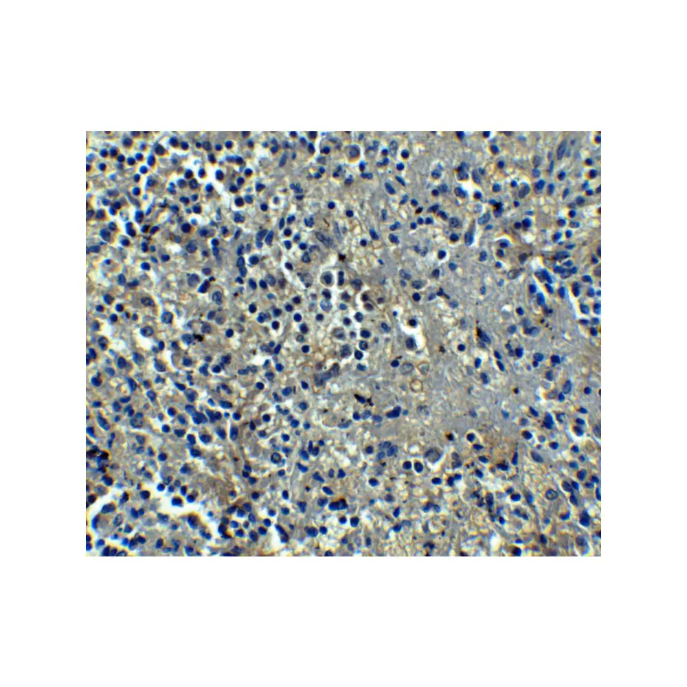 ProSci PM-5207_S ORAI1 Antibody [6D11A11] , ProSci, 0.02 mg/Unit Secondary Image