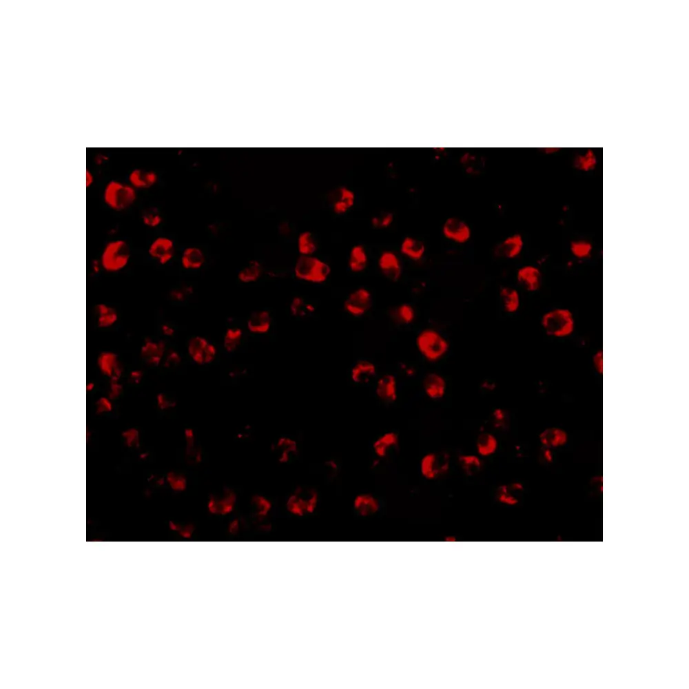ProSci 5075 OTUD4 Antibody, ProSci, 0.1 mg/Unit Tertiary Image