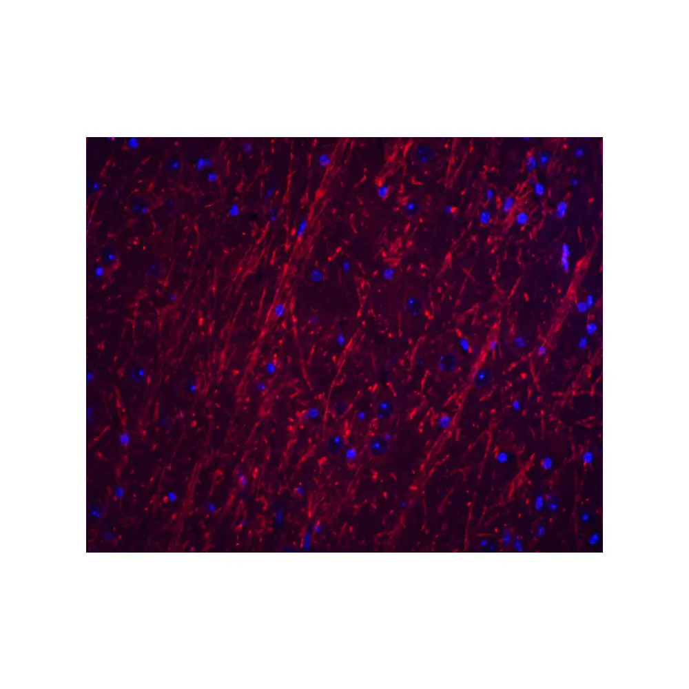 ProSci 8189 PACS2 Antibody, ProSci, 0.1 mg/Unit Tertiary Image