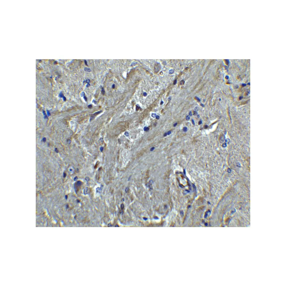 ProSci 8189 PACS2 Antibody, ProSci, 0.1 mg/Unit Secondary Image