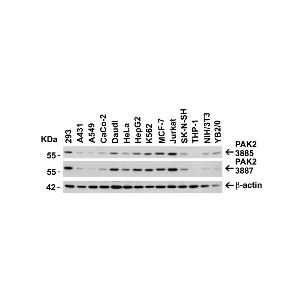 ProSci 3885 PAK2 Antibody, ProSci, 0.1 mg/Unit Secondary Image